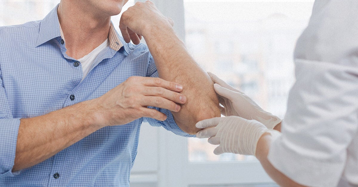 hives or psoriasis