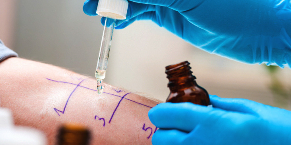 allergy test