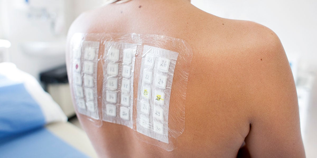 Skin prick test