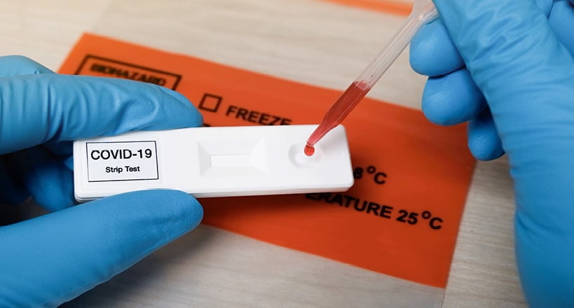 COVID-19 Antibody Test