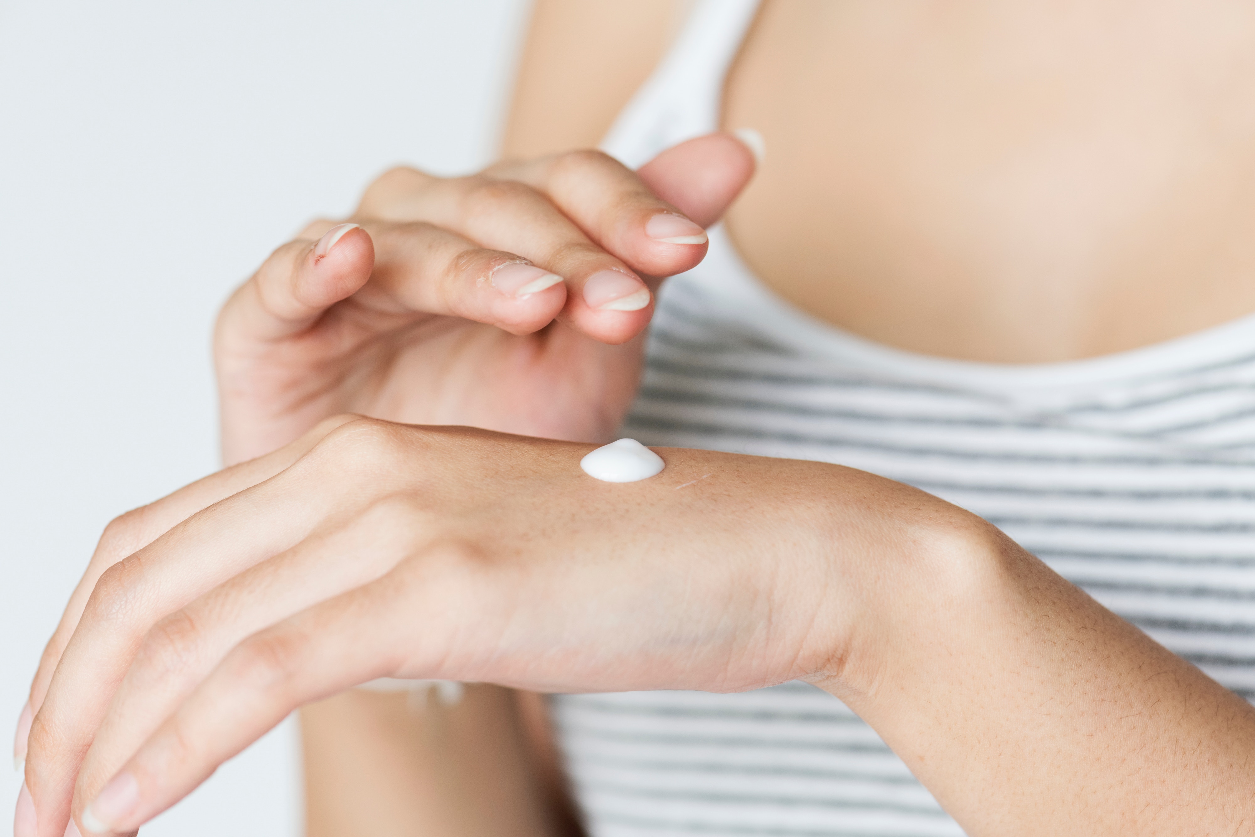 Anti-Itch Creams Feature Image